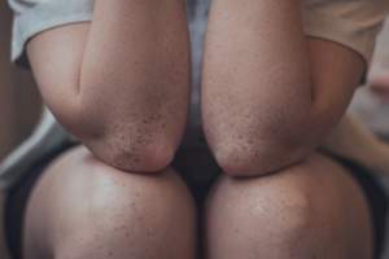 Foto: Photo by Lucaxx Freire on Unsplash